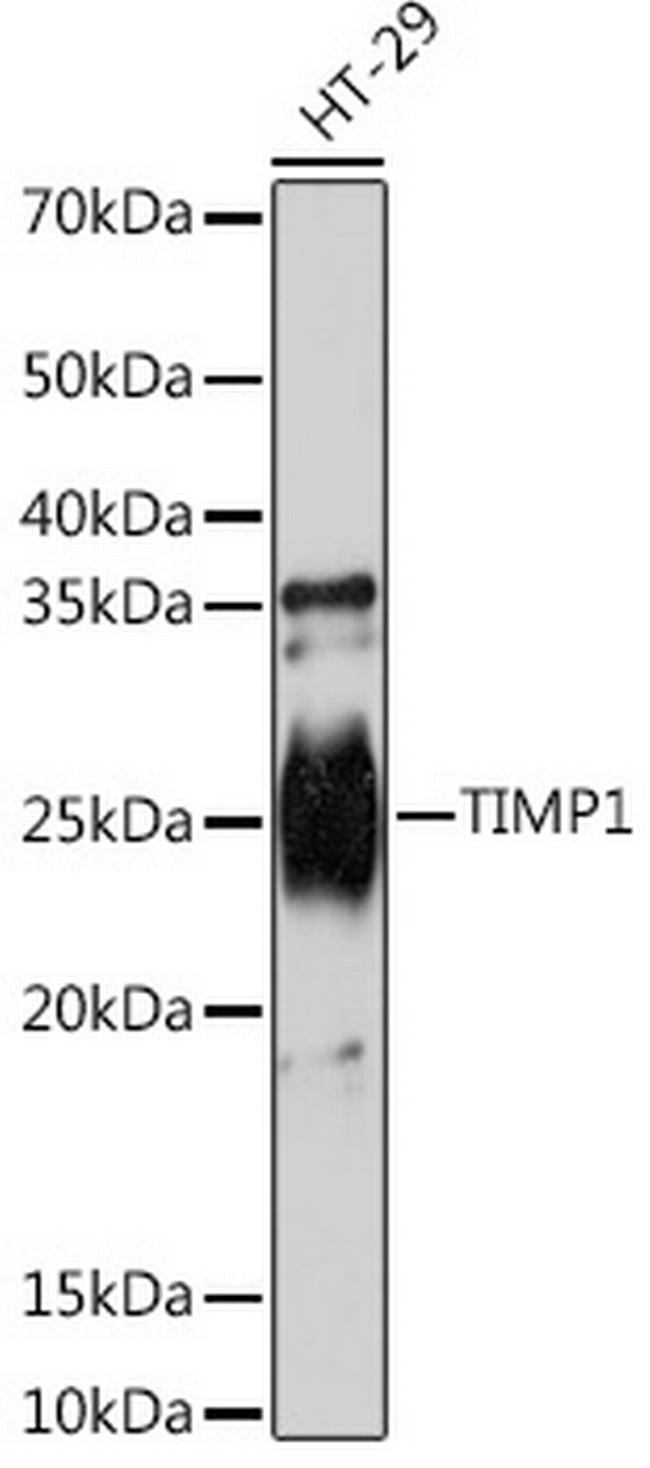 TIMP1 Antibody in Western Blot (WB)