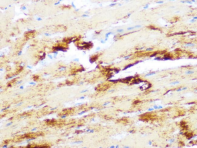 Myosin Heavy Chain Antibody in Immunohistochemistry (Paraffin) (IHC (P))