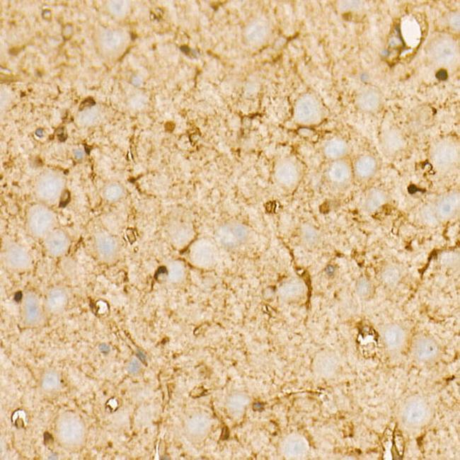 PI3K p85 alpha Antibody in Immunohistochemistry (Paraffin) (IHC (P))