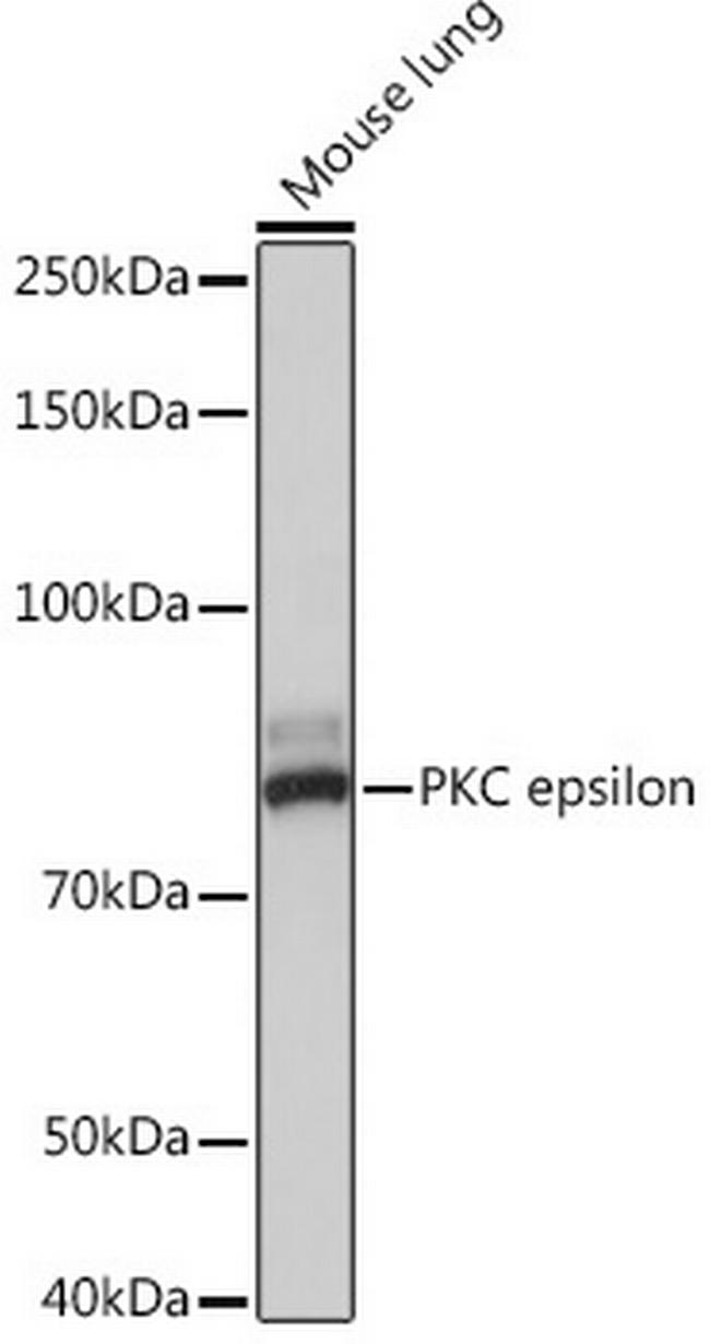 PKC epsilon Antibody in Western Blot (WB)