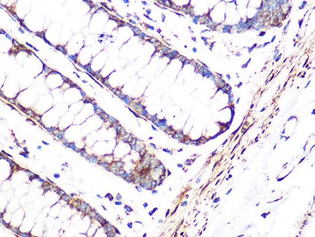 FHL1 Antibody in Immunohistochemistry (Paraffin) (IHC (P))