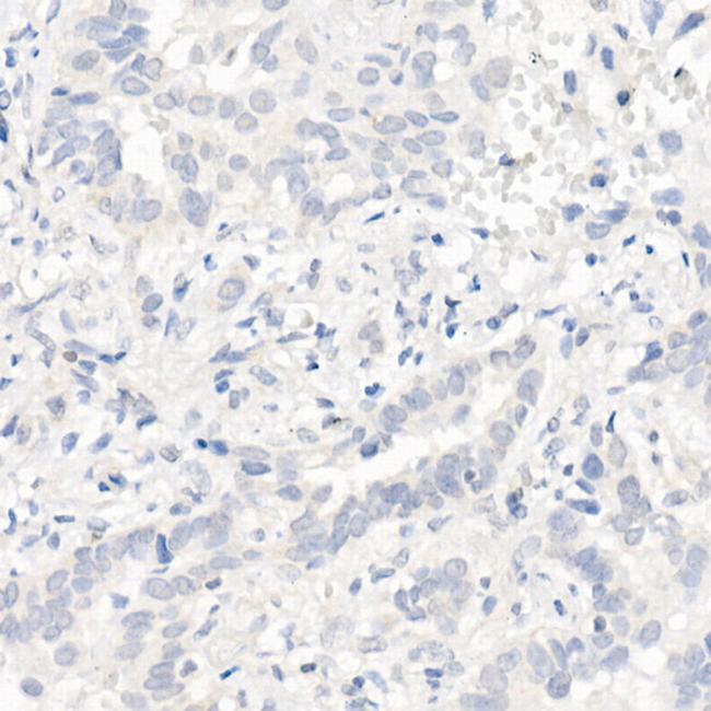 EGFR Antibody in Immunohistochemistry (Paraffin) (IHC (P))