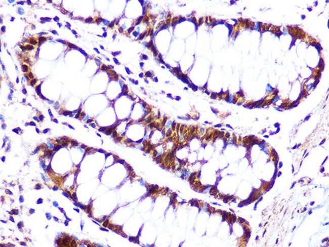 Cullin 4A Antibody in Immunohistochemistry (Paraffin) (IHC (P))