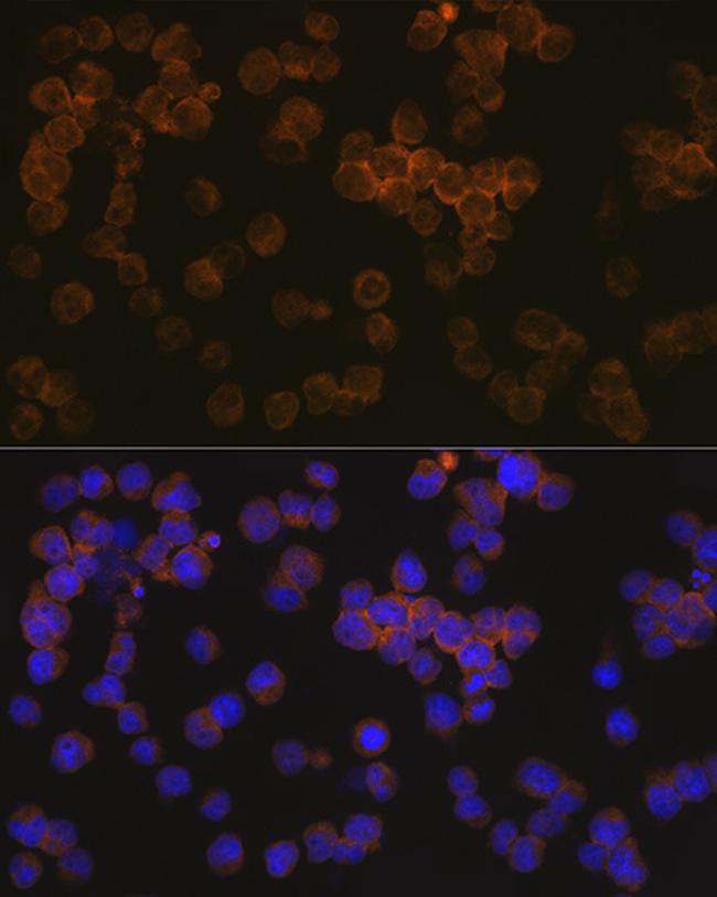 WASP Antibody in Immunocytochemistry (ICC/IF)