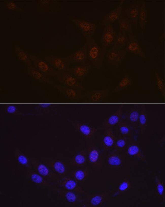 RAD23A Antibody in Immunocytochemistry (ICC/IF)