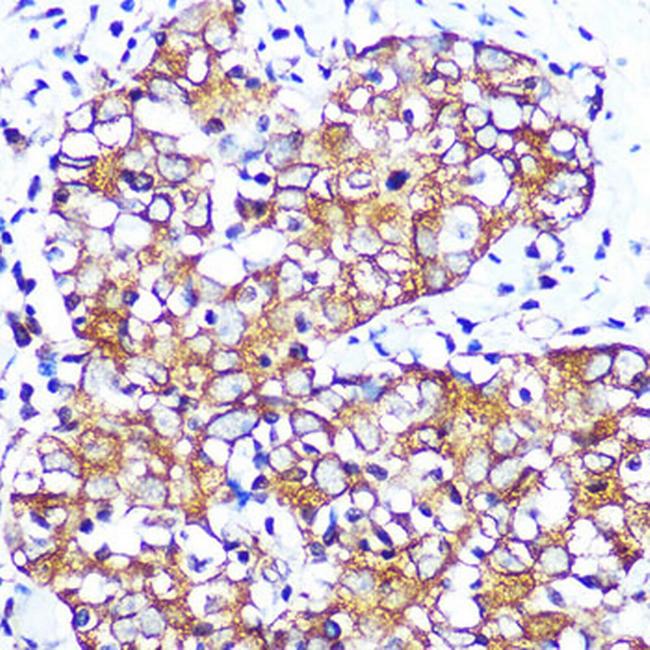 CHRM2 Antibody in Immunohistochemistry (Paraffin) (IHC (P))