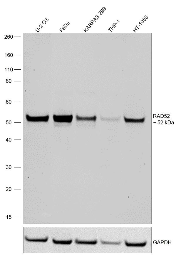 RAD52 Antibody in Western Blot (WB)