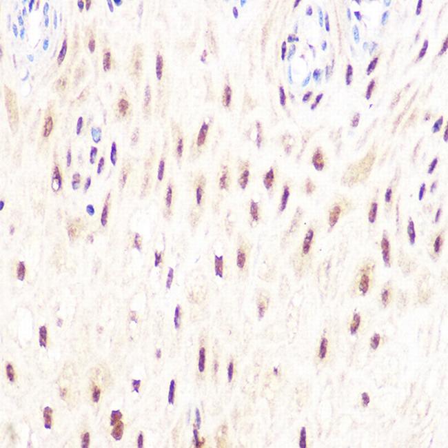 DP1 Antibody in Immunohistochemistry (Paraffin) (IHC (P))