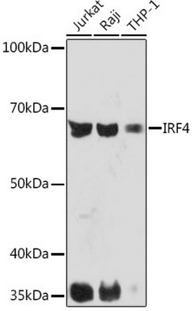 IRF4 Antibody in Western Blot (WB)