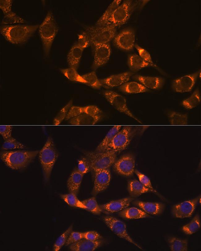 DLD Antibody in Immunocytochemistry (ICC/IF)