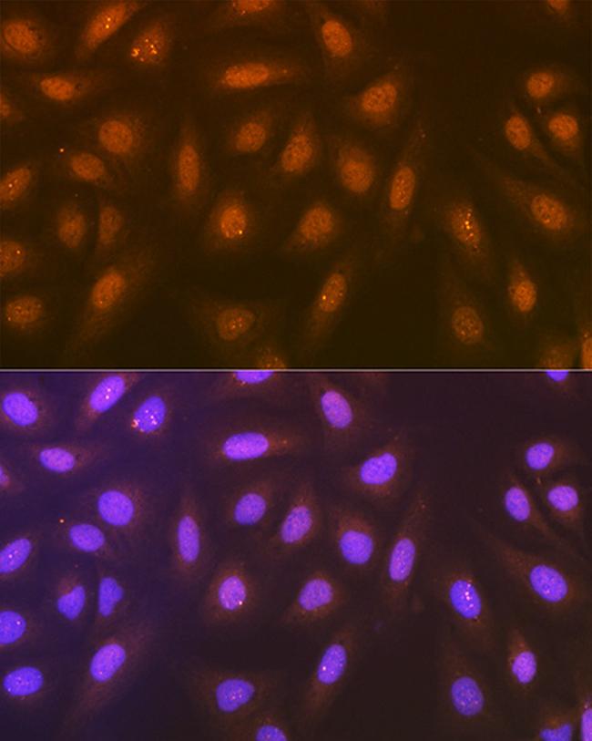 Syntenin 1 Antibody in Immunocytochemistry (ICC/IF)