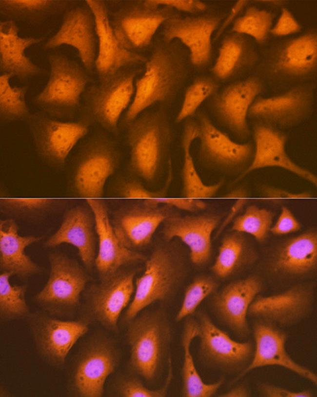 HSPA2 Antibody in Immunocytochemistry (ICC/IF)