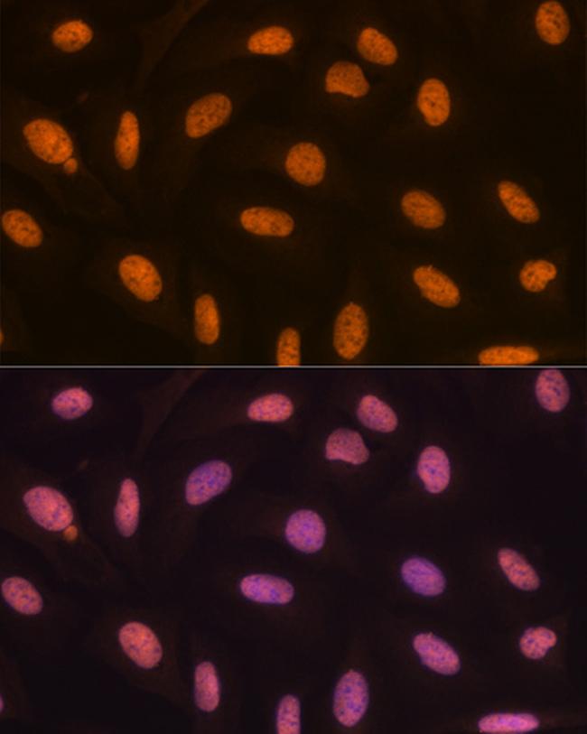 JMJD2B Antibody in Immunocytochemistry (ICC/IF)