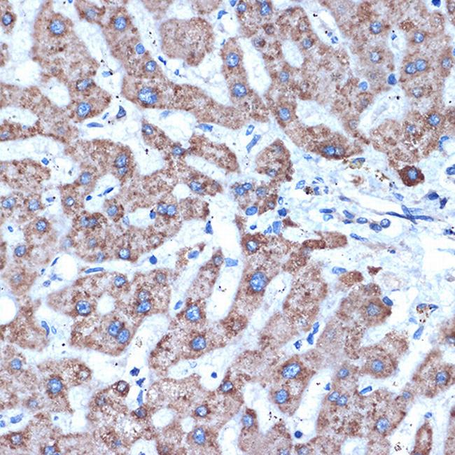 ADAM15 Antibody in Immunohistochemistry (Paraffin) (IHC (P))