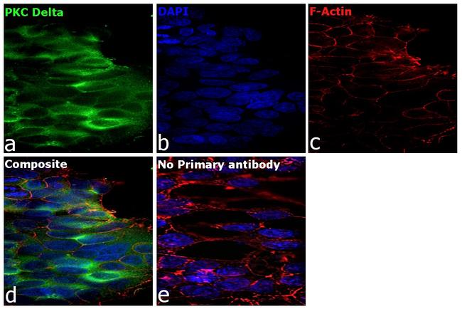 PKC delta Antibody in Immunocytochemistry (ICC/IF)