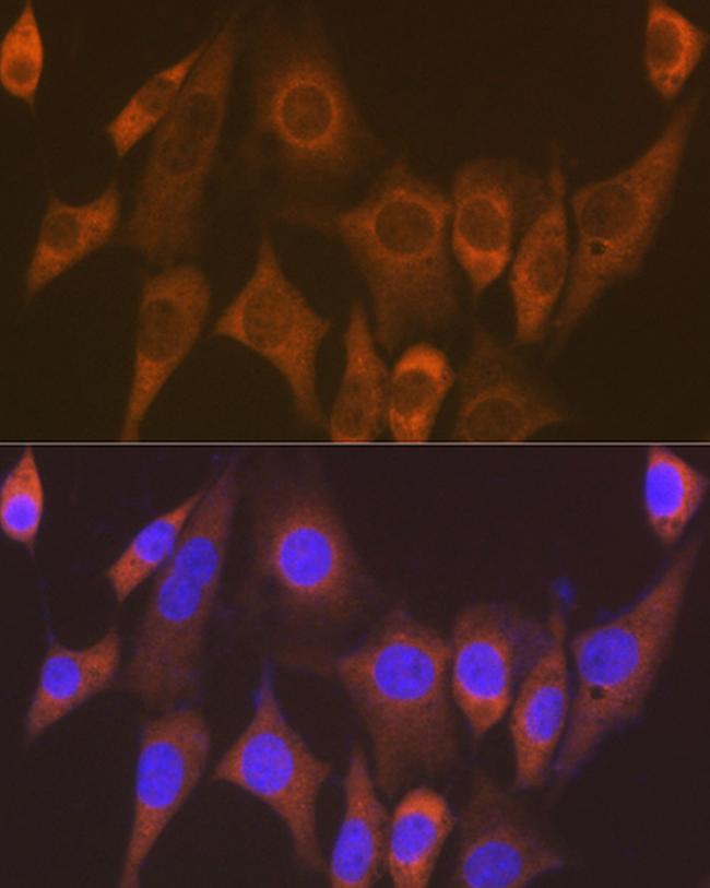 EEF1G Antibody in Immunocytochemistry (ICC/IF)