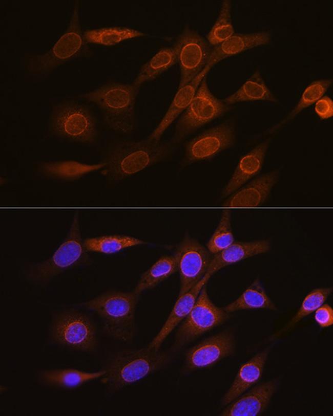 RANGAP1 Antibody in Immunocytochemistry (ICC/IF)