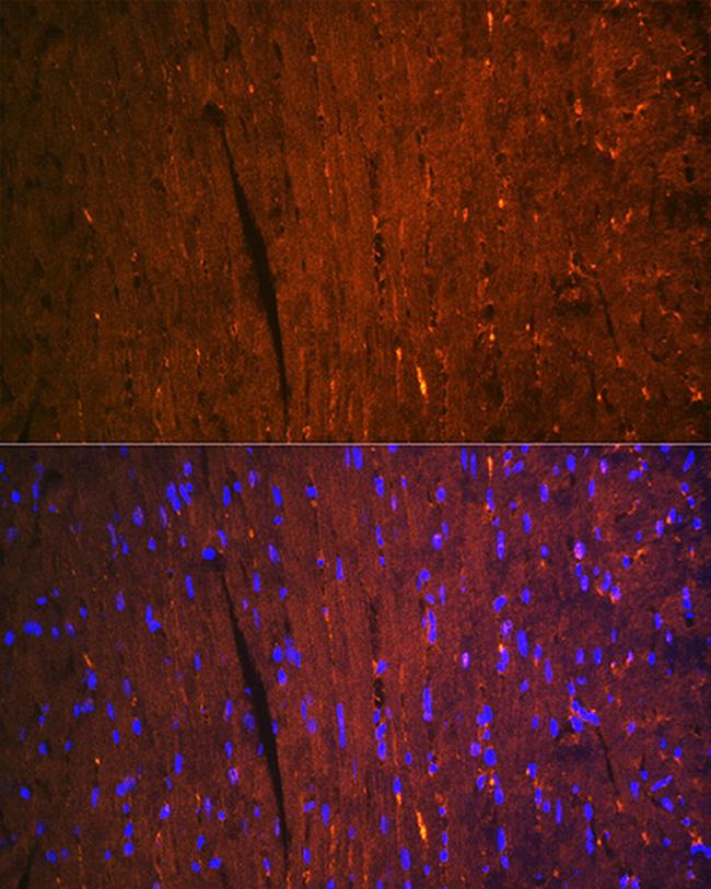 FABP3 Antibody in Immunohistochemistry (Paraffin) (IHC (P))