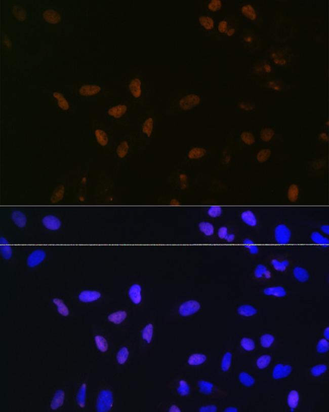 Bub3 Antibody in Immunocytochemistry (ICC/IF)