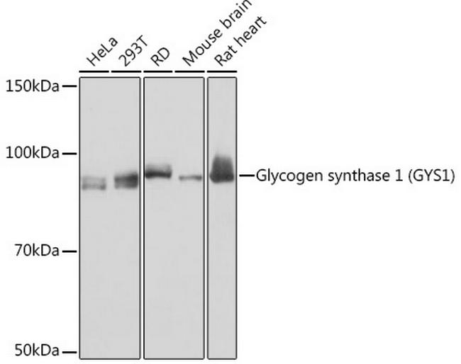 GYS1 Antibody in Western Blot (WB)