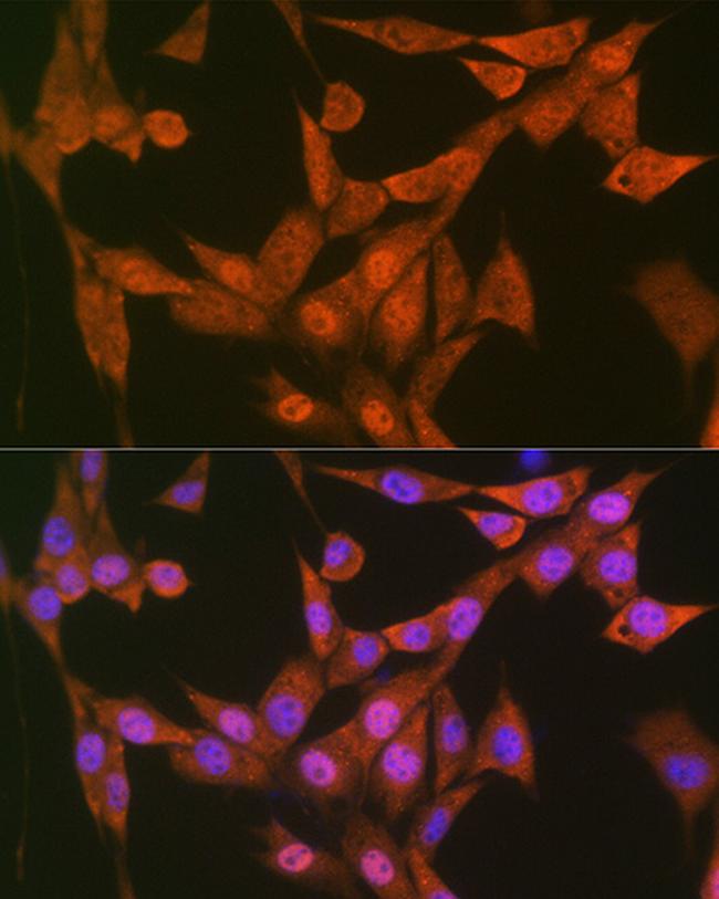 LTA4H Antibody in Immunocytochemistry (ICC/IF)