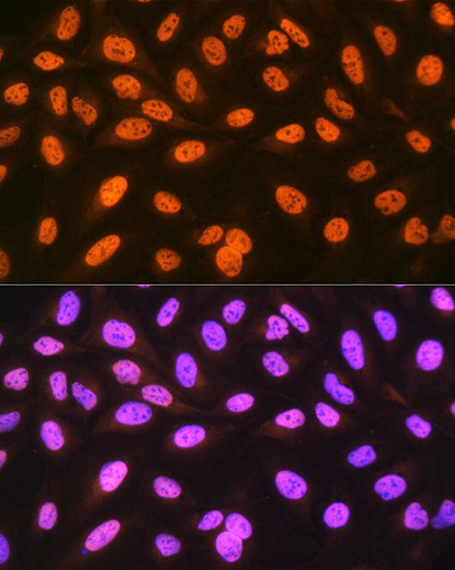 hnRNP C Antibody in Immunocytochemistry (ICC/IF)