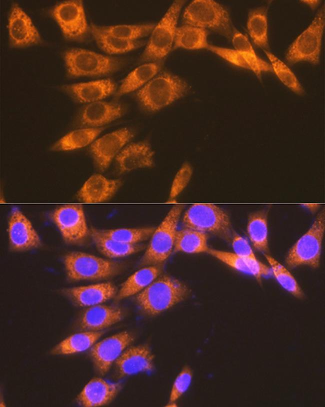 PTGER2 Antibody in Immunocytochemistry (ICC/IF)