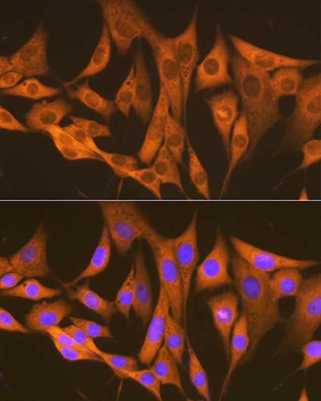 ASS1 Antibody in Immunocytochemistry (ICC/IF)