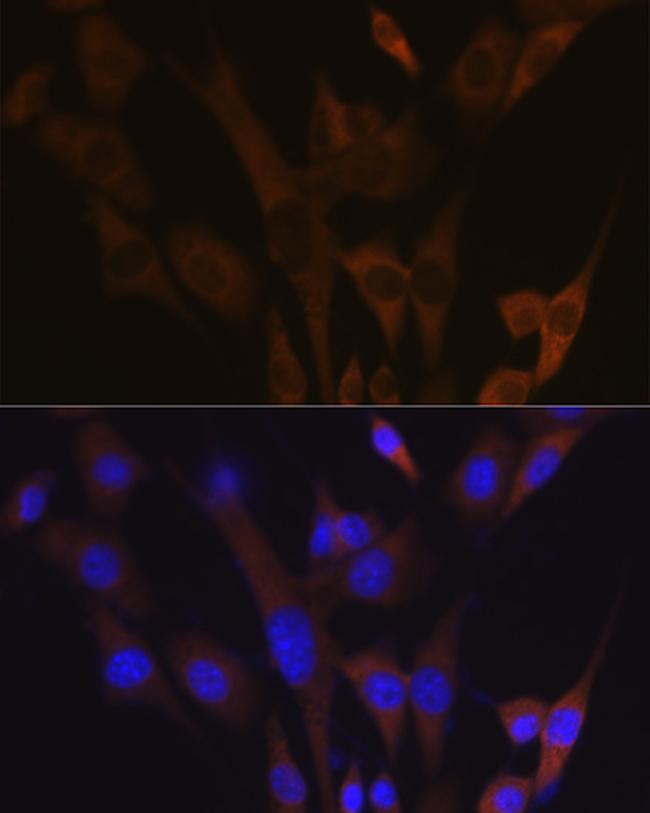 ABCE1 Antibody in Immunocytochemistry (ICC/IF)