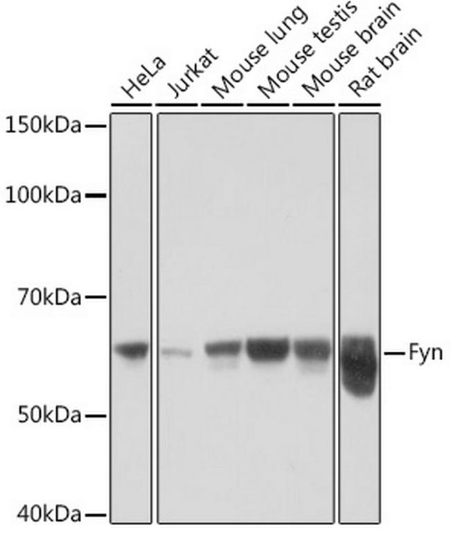 Fyn Antibody in Western Blot (WB)