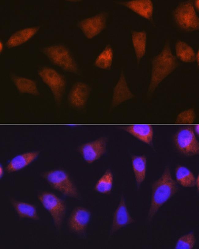 PSMA2 Antibody in Immunocytochemistry (ICC/IF)