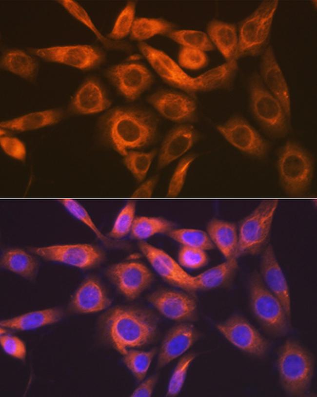 IMPDH2 Antibody in Immunocytochemistry (ICC/IF)