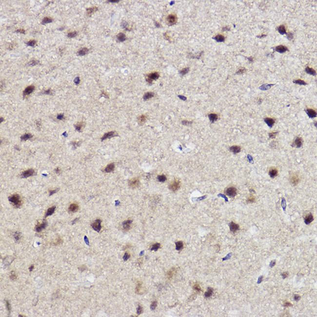 ABH1 Antibody in Immunohistochemistry (Paraffin) (IHC (P))