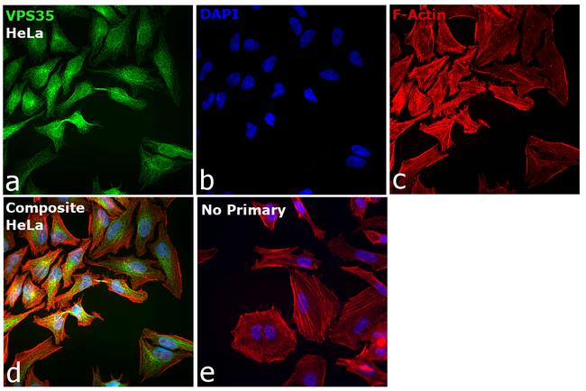 VPS35 Antibody in Immunocytochemistry (ICC/IF)