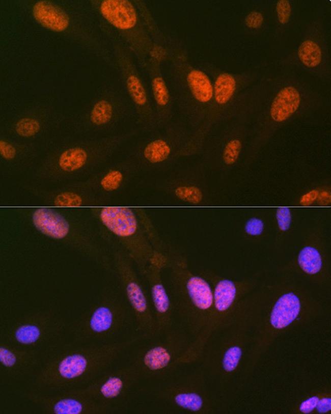 HIPK2 Antibody in Immunocytochemistry (ICC/IF)