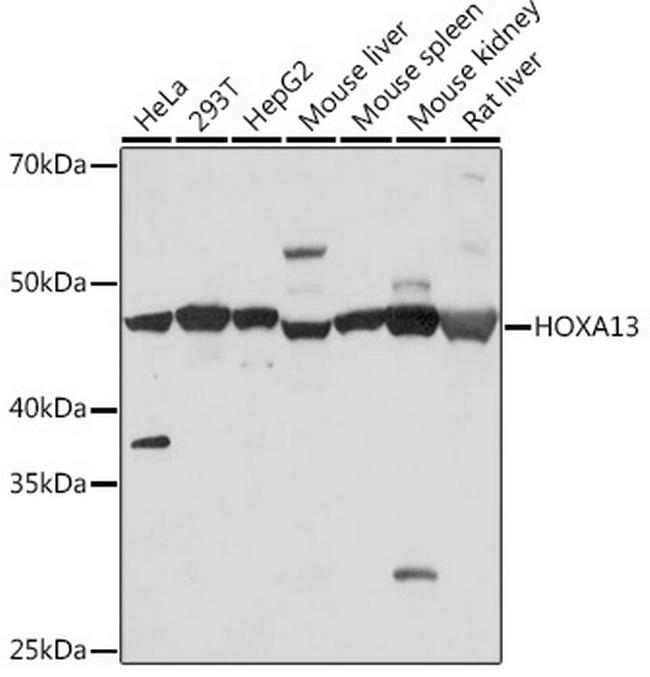 HOXA13 Antibody in Western Blot (WB)