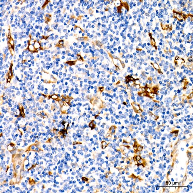 Fascin Antibody in Immunohistochemistry (Paraffin) (IHC (P))