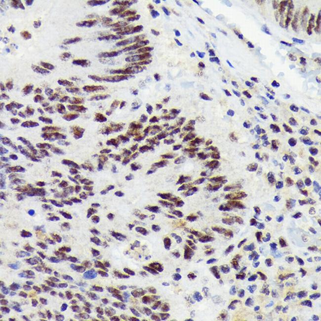 RNF40 Antibody in Immunohistochemistry (Paraffin) (IHC (P))