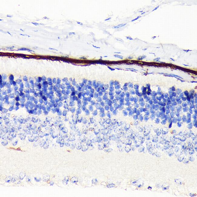 RPE65 Antibody in Immunohistochemistry (Paraffin) (IHC (P))