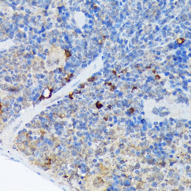 CARD11 Antibody in Immunohistochemistry (Paraffin) (IHC (P))