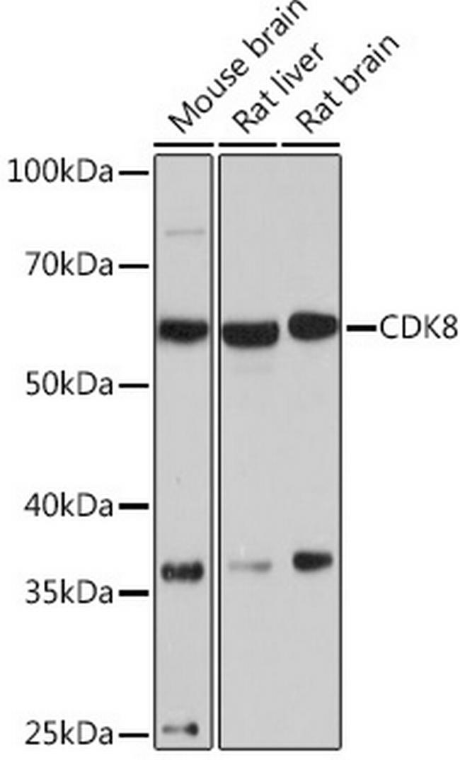 CDK8 Antibody in Western Blot (WB)