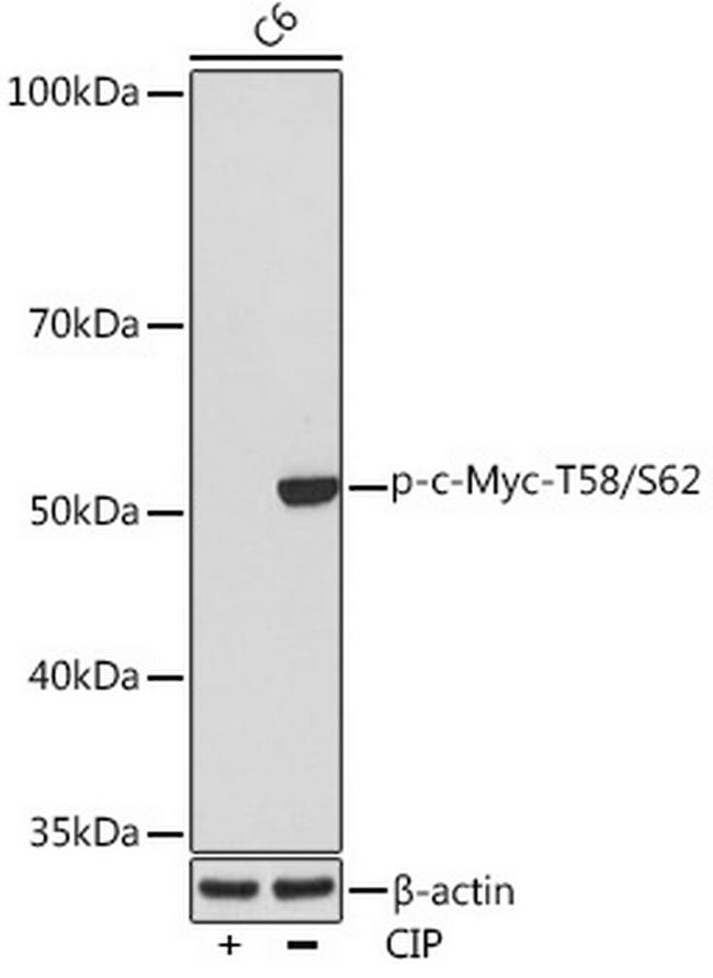 Phospho-c-Myc (Thr58, Ser62) Antibody in Western Blot (WB)