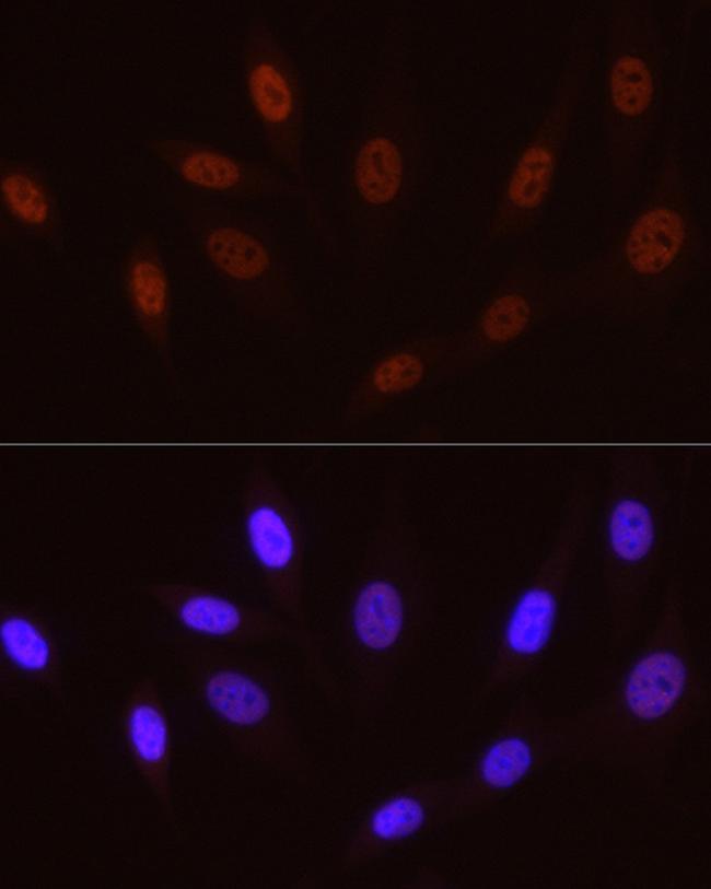 Phospho-POLR2A (Ser5) Antibody in Immunocytochemistry (ICC/IF)