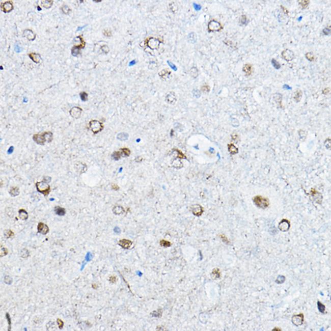 Phospho-Tau (Ser396) Antibody in Immunohistochemistry (Paraffin) (IHC (P))