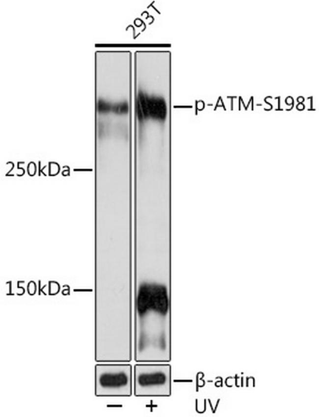 Phospho-ATM (Ser1981) Antibody in Western Blot (WB)