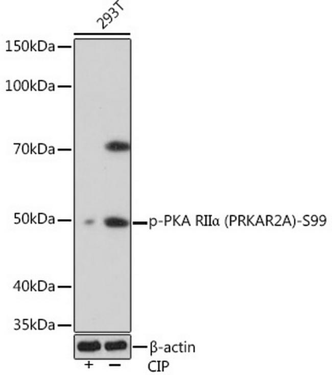 Phospho-PRKAR2A (Ser99) Antibody in Western Blot (WB)