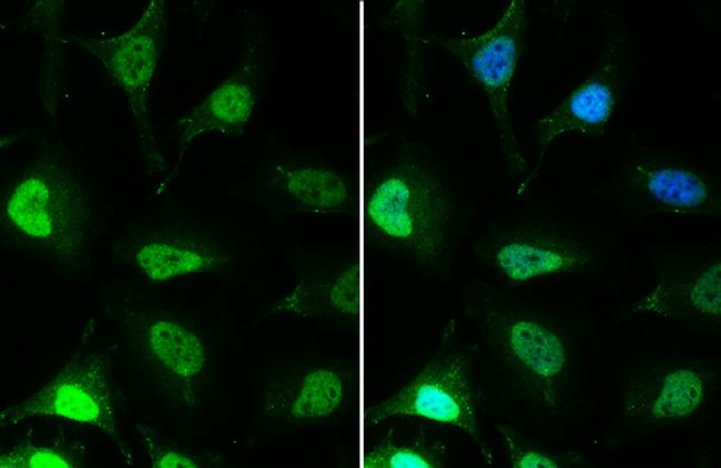 EED Antibody in Immunocytochemistry (ICC/IF)