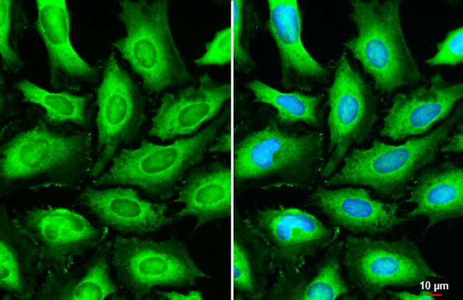 beta Dystroglycan Antibody in Immunocytochemistry (ICC/IF)