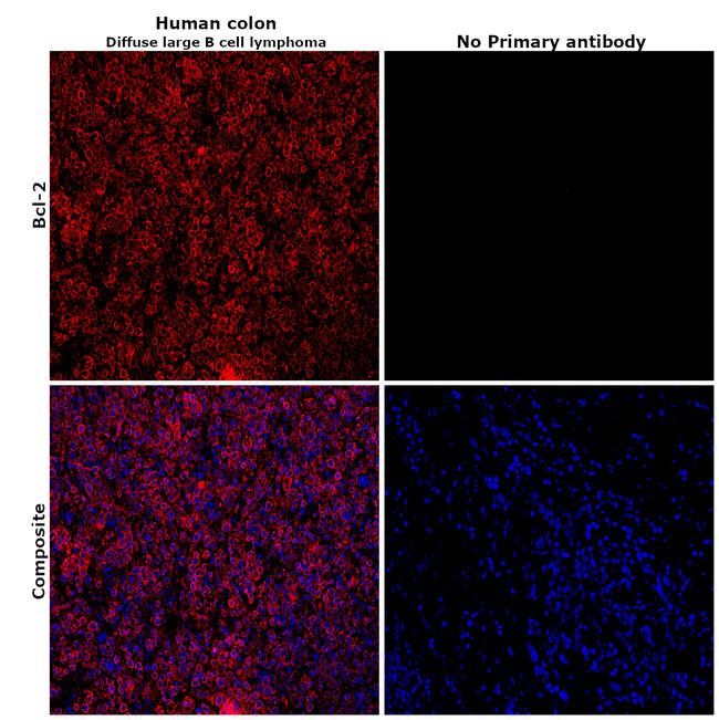 Bcl-2 Antibody in Immunohistochemistry (Paraffin) (IHC (P))