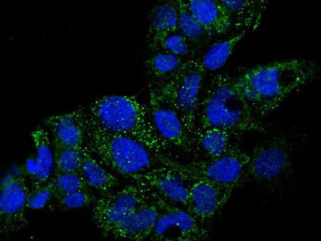 GDF3 Antibody in Immunocytochemistry (ICC/IF)